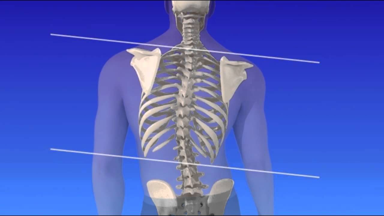 ejercicios para escoliosis